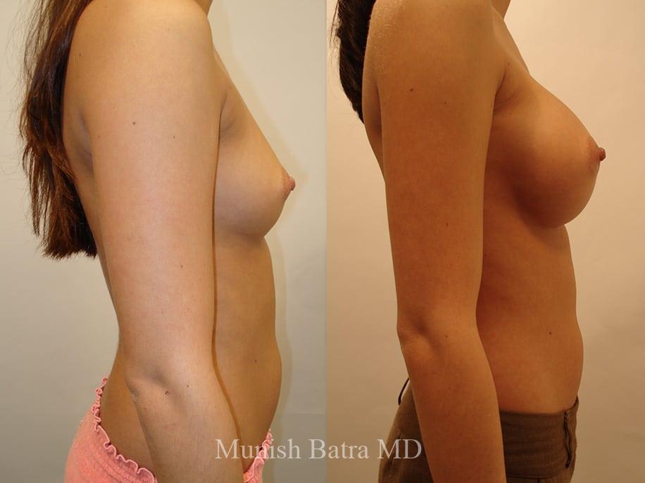 Before and After Image