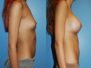 Before and After Image