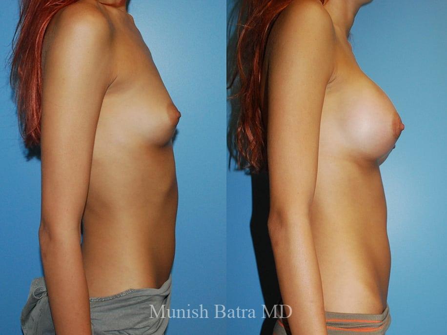 Before and After Image