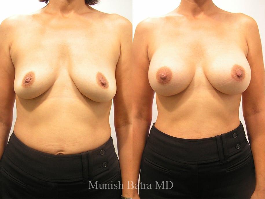 Before and After Image