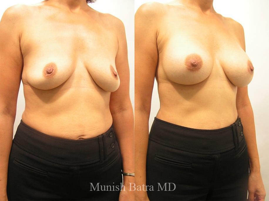 Before and After Image