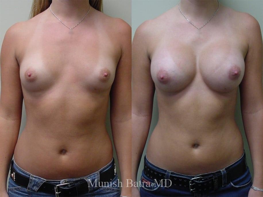 Before and After Image