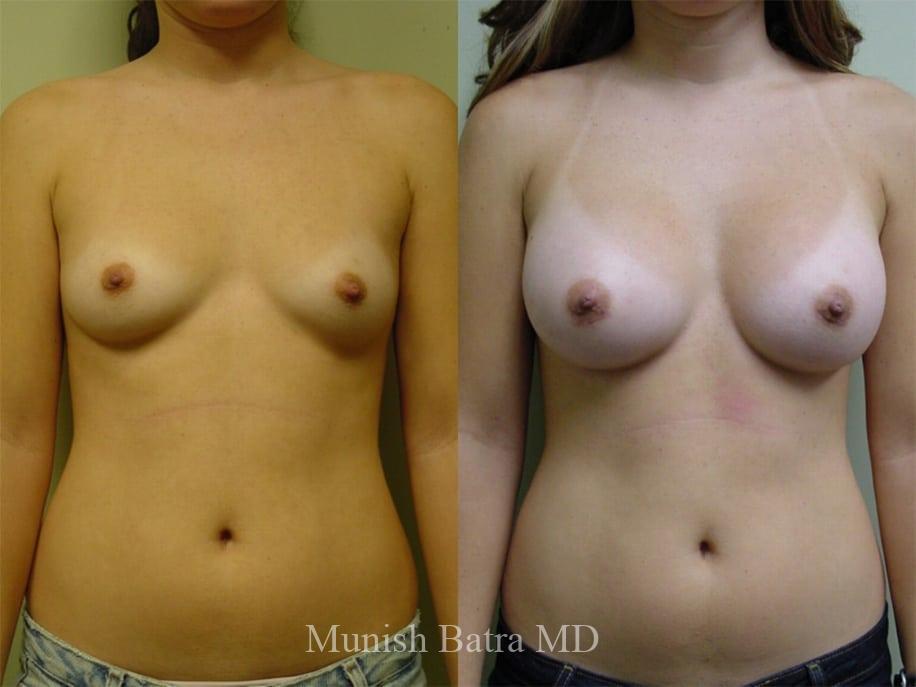 Before and After Image