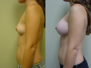 Before and After Image