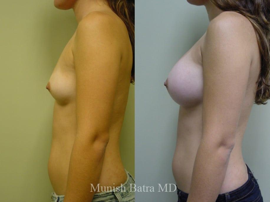 Before and After Image