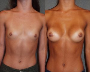 Before and After Image