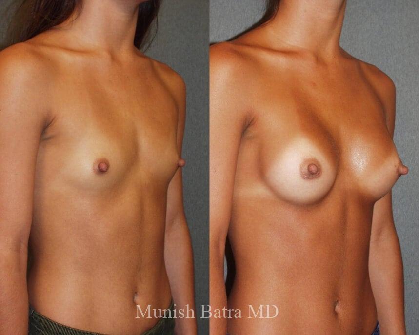 Before and After Image