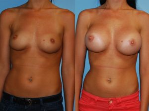 Before and After Image
