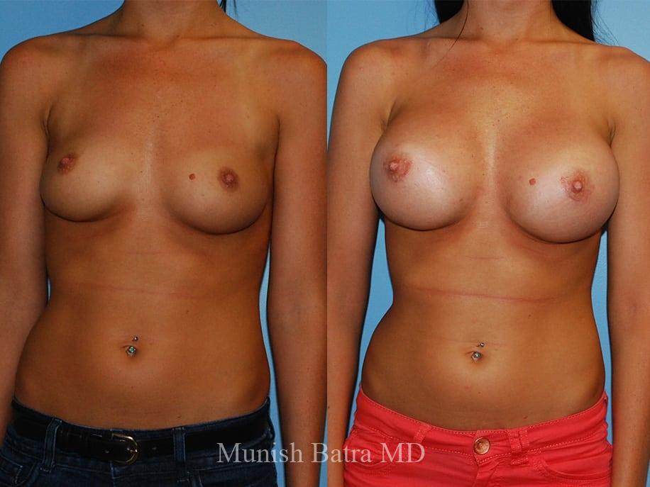 Before and After Image