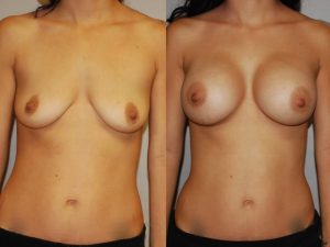 Before and After Image