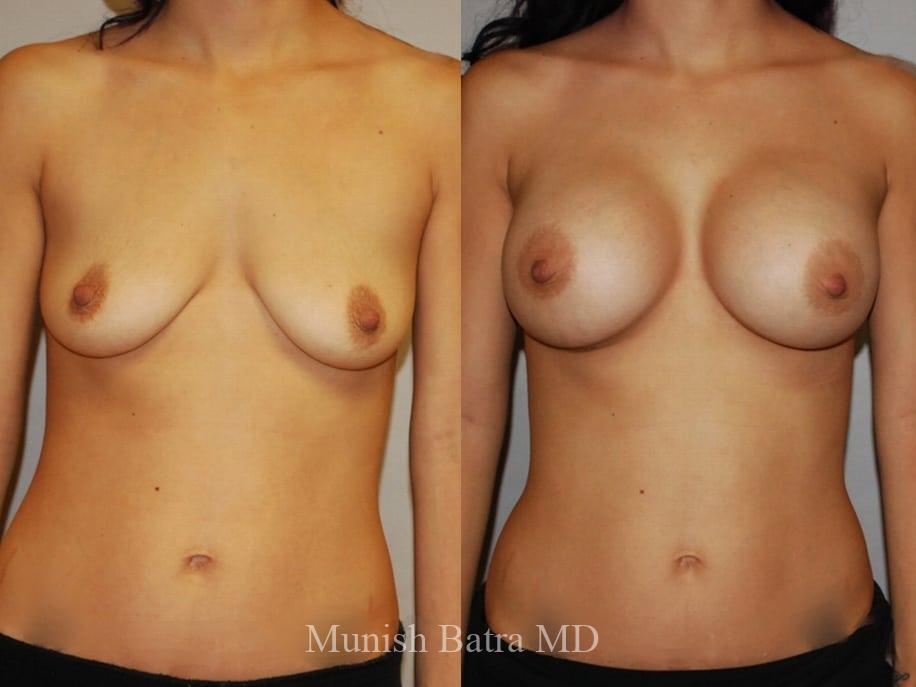 Before and After Image