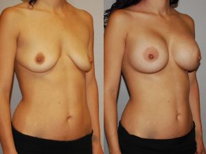 Before and After Image