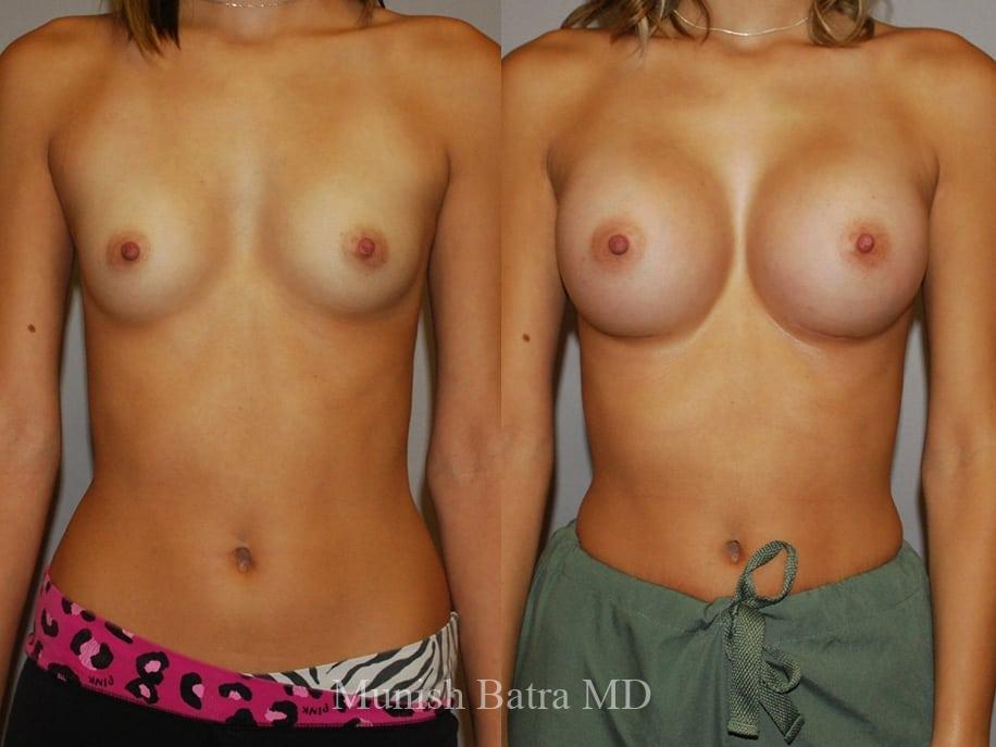 Before and After Image