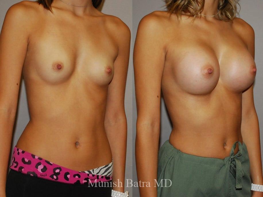 Before and After Image