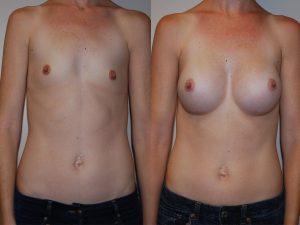 Before and After Image