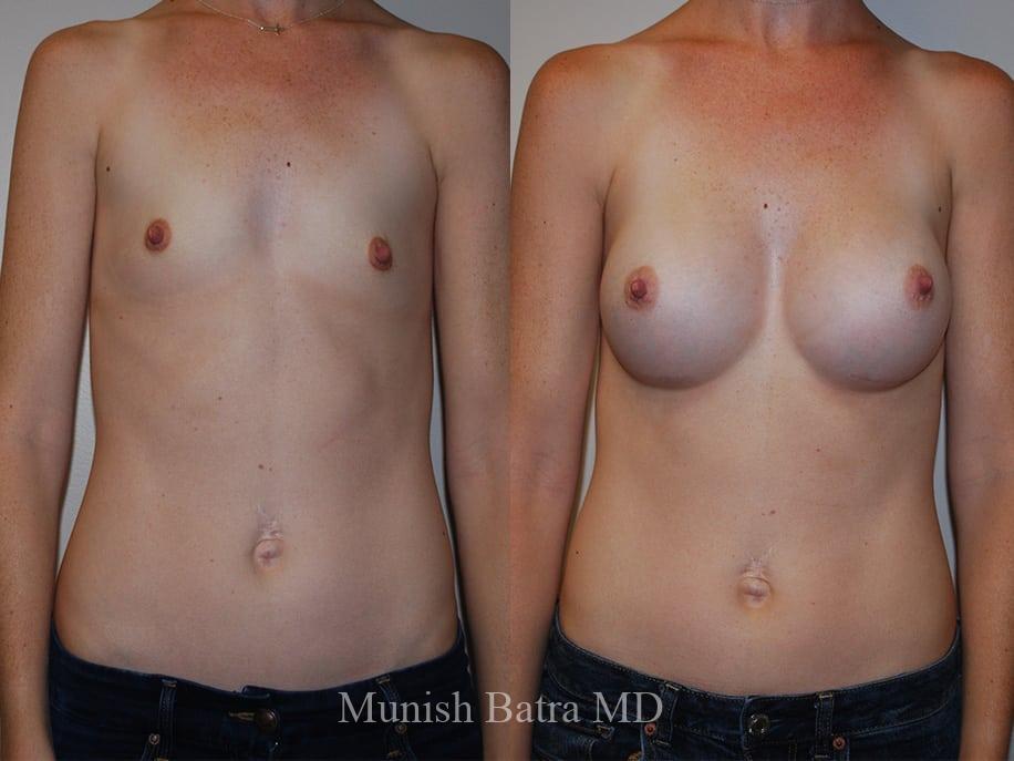 Before and After Image