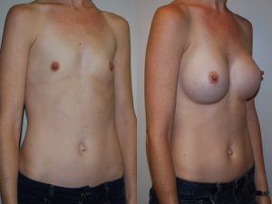 Before and After Image