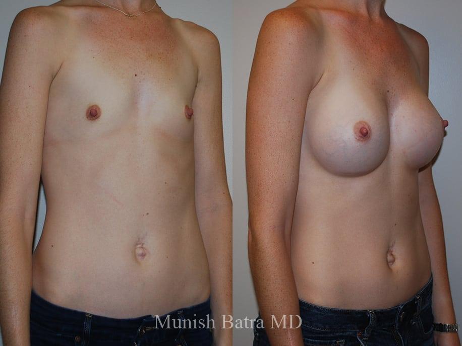 Before and After Image
