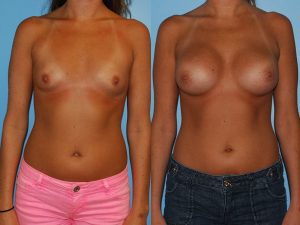 Before and After Image