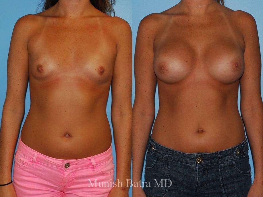 Before and After Image
