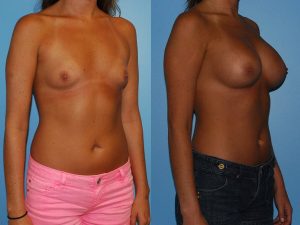 Before and After Image