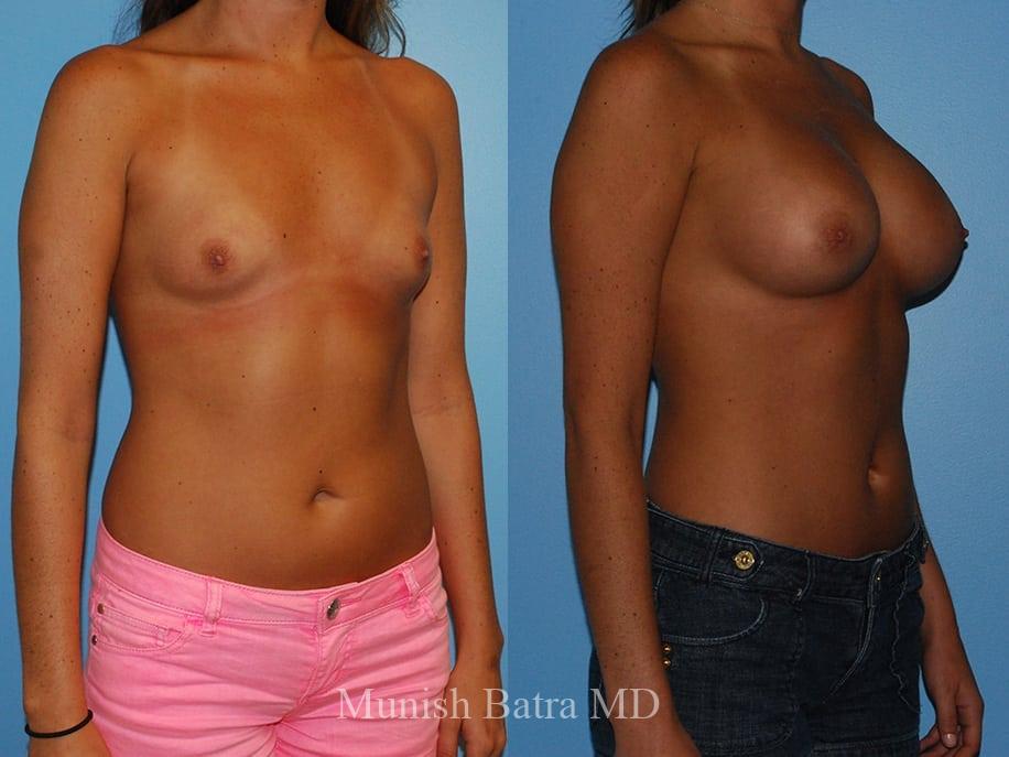 Before and After Image