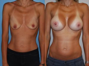 Before and After Image