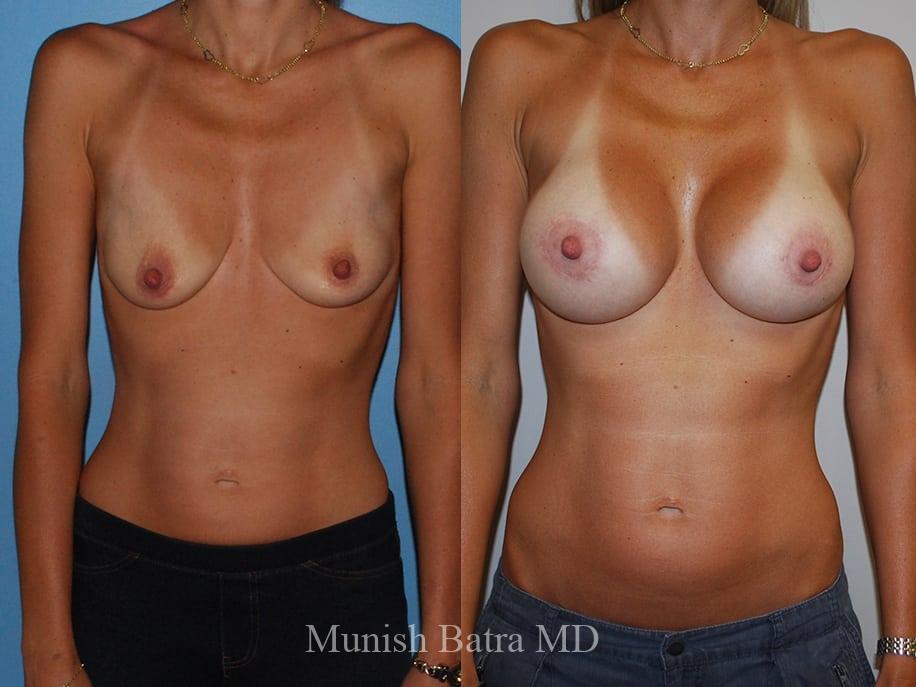 Before and After Image