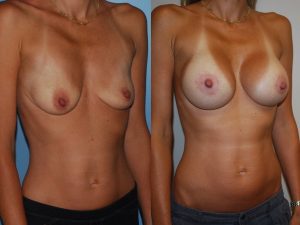 Before and After Image