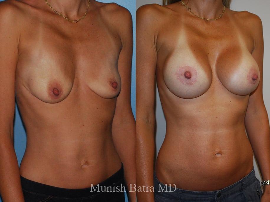 Before and After Image