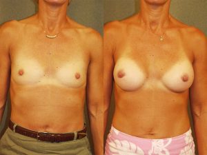 Before and After Image
