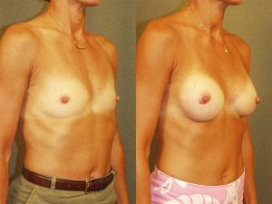 Before and After Image