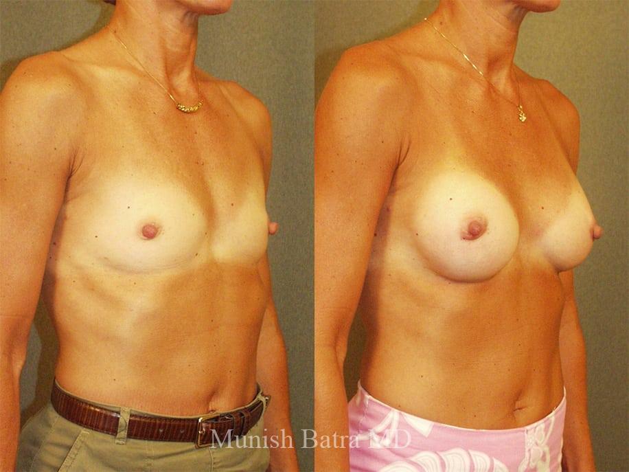 Before and After Image