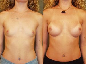 Before and After Image