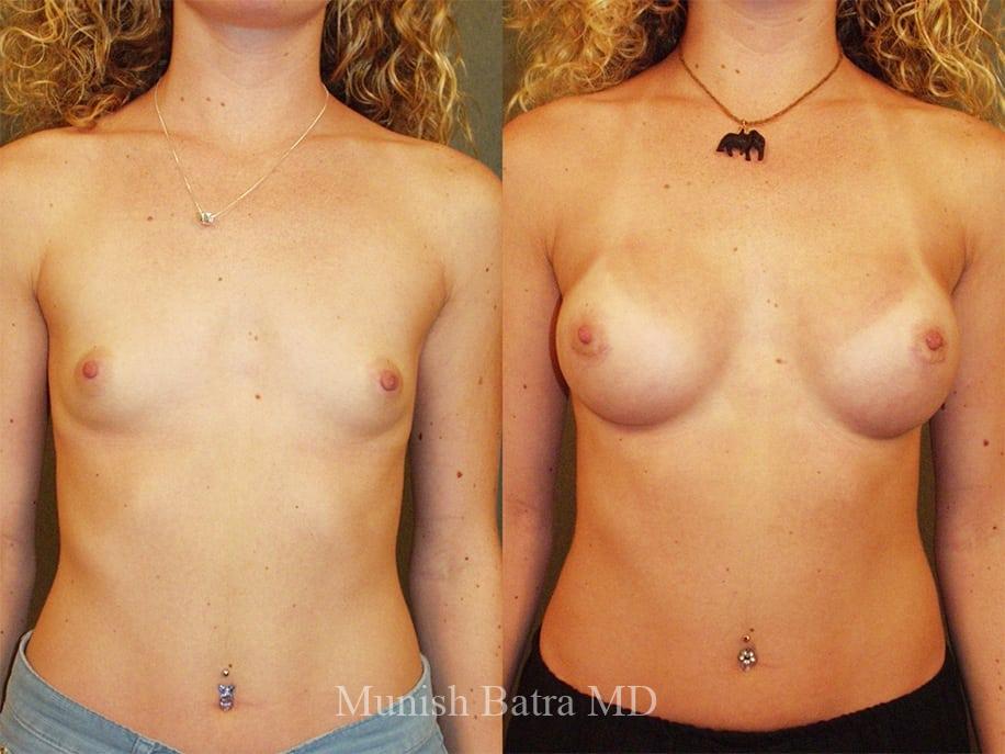 Before and After Image