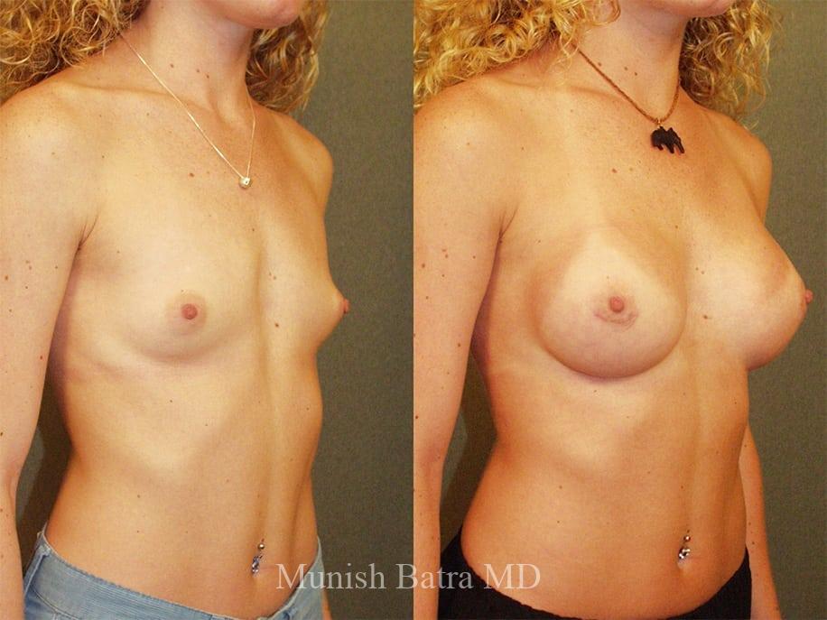 Before and After Image