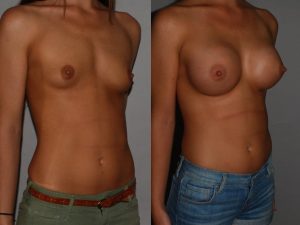 Before and After Image