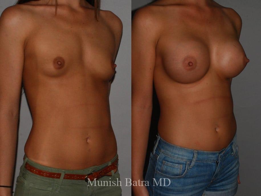 Before and After Image