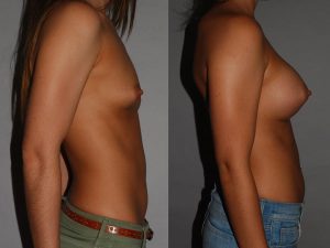 Before and After Image