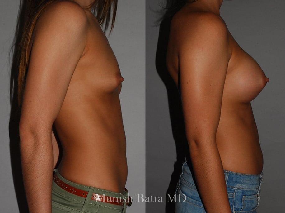 Before and After Image