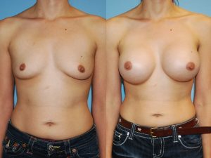 Before and After Image