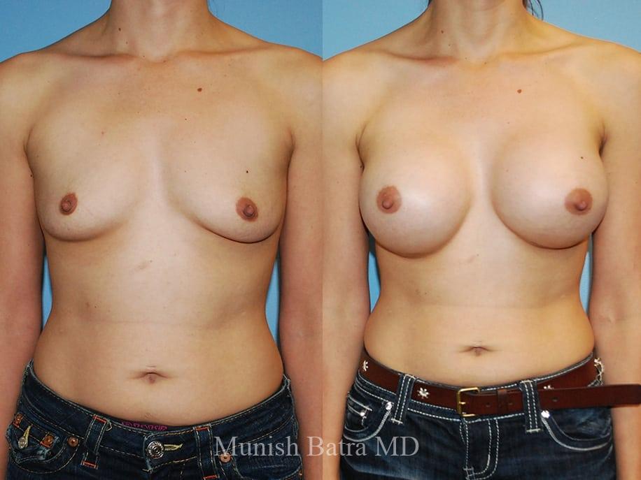 Before and After Image