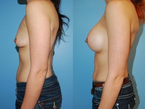 Before and After Image