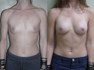 Before and After Image