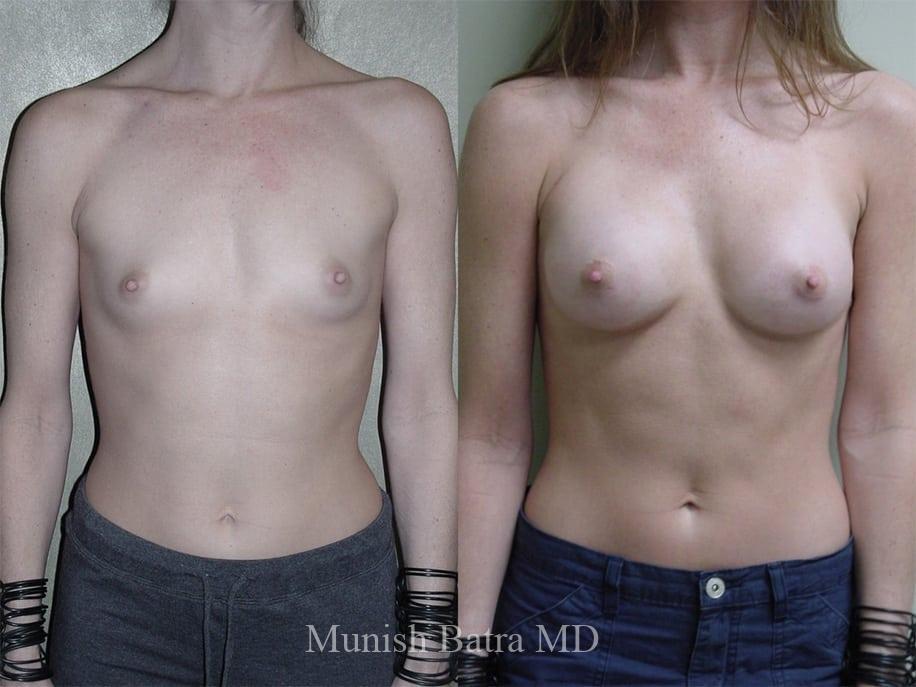 Before and After Image