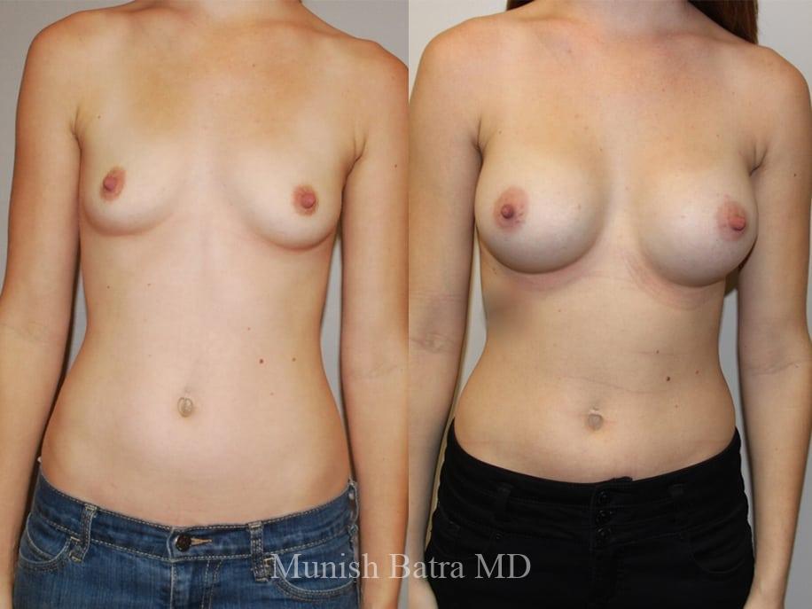 Before and After Image