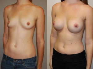 Before and After Image