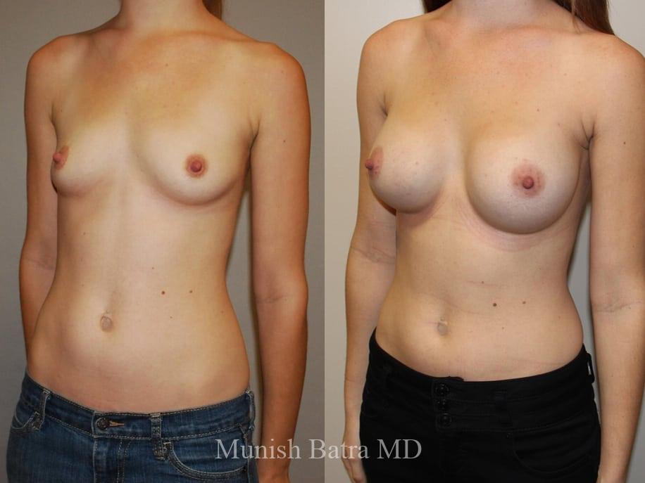 Before and After Image
