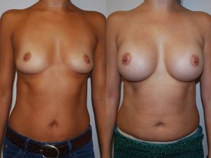Before and After Image
