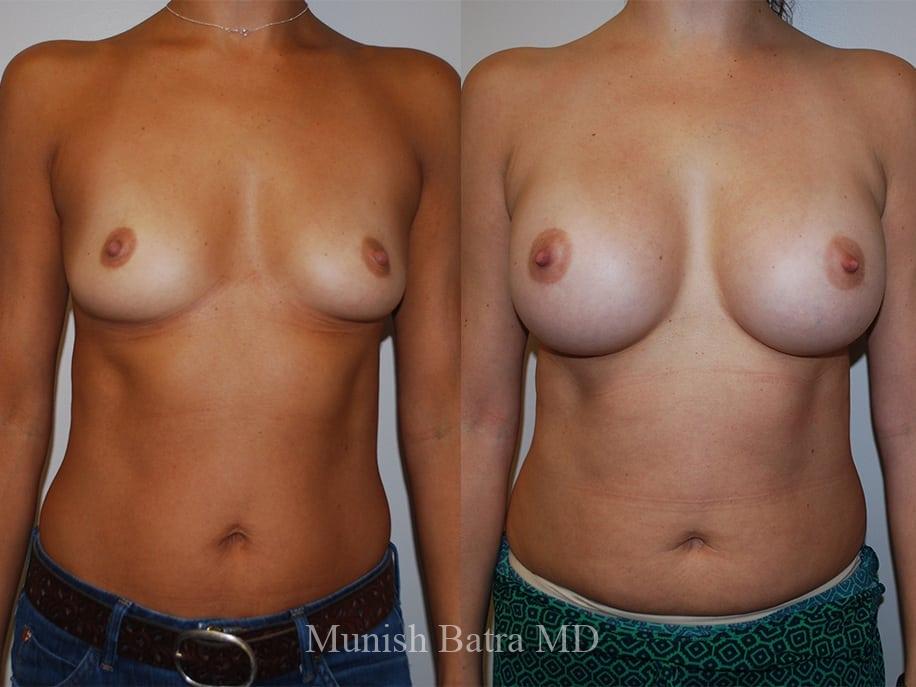 Before and After Image